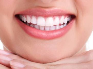 Resultados: sonrisa más blanca y luminosa
